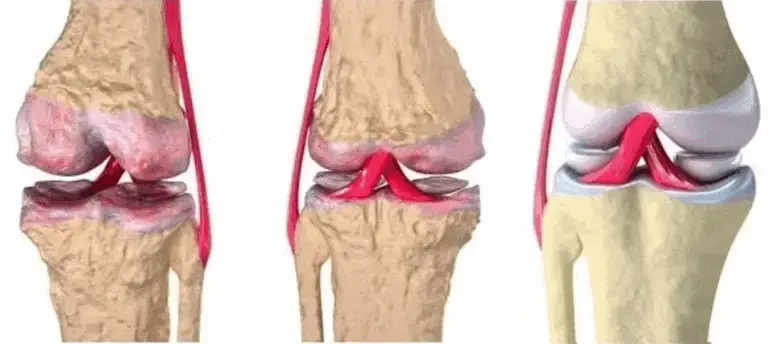 Схема работы мази