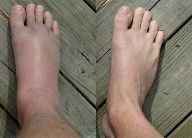 comment photo review